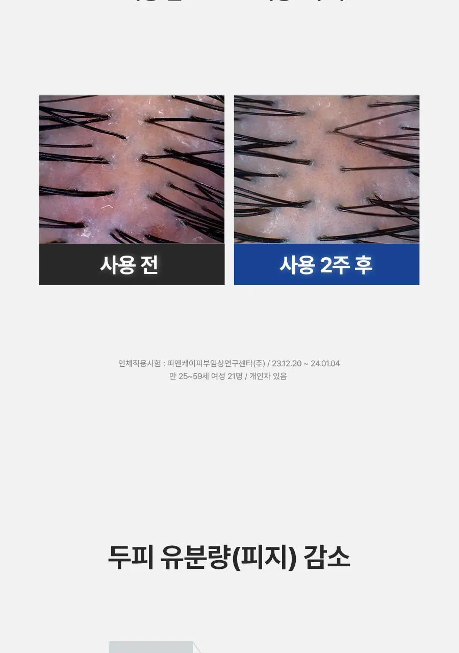 [피지순삭/탈모증상완화] 아로마티카 티트리 퓨리파잉 샴푸 400ml (단품/더블기획/리필) 상세페이지 12